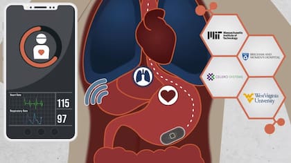 Investigadores del MIT crearon una computadora del tamaño de una píldora que mide el ritmo cardíaco y la respiración de un paciente desde el interior de su cuerpo