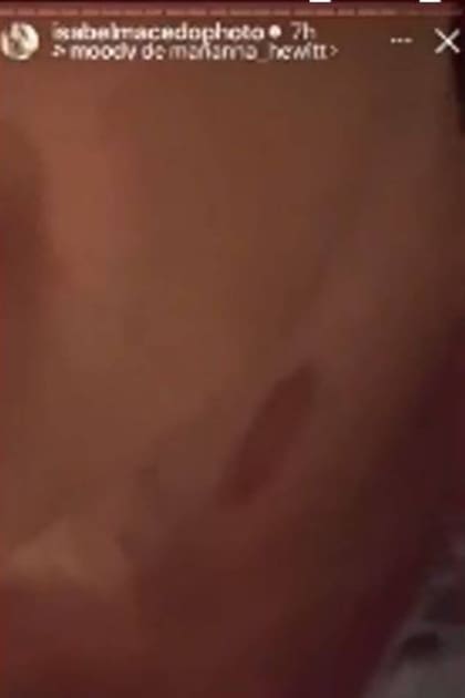 Isabel Macedo hizo un par de aproximamientos con el celular a la marca que le dejó la buclera