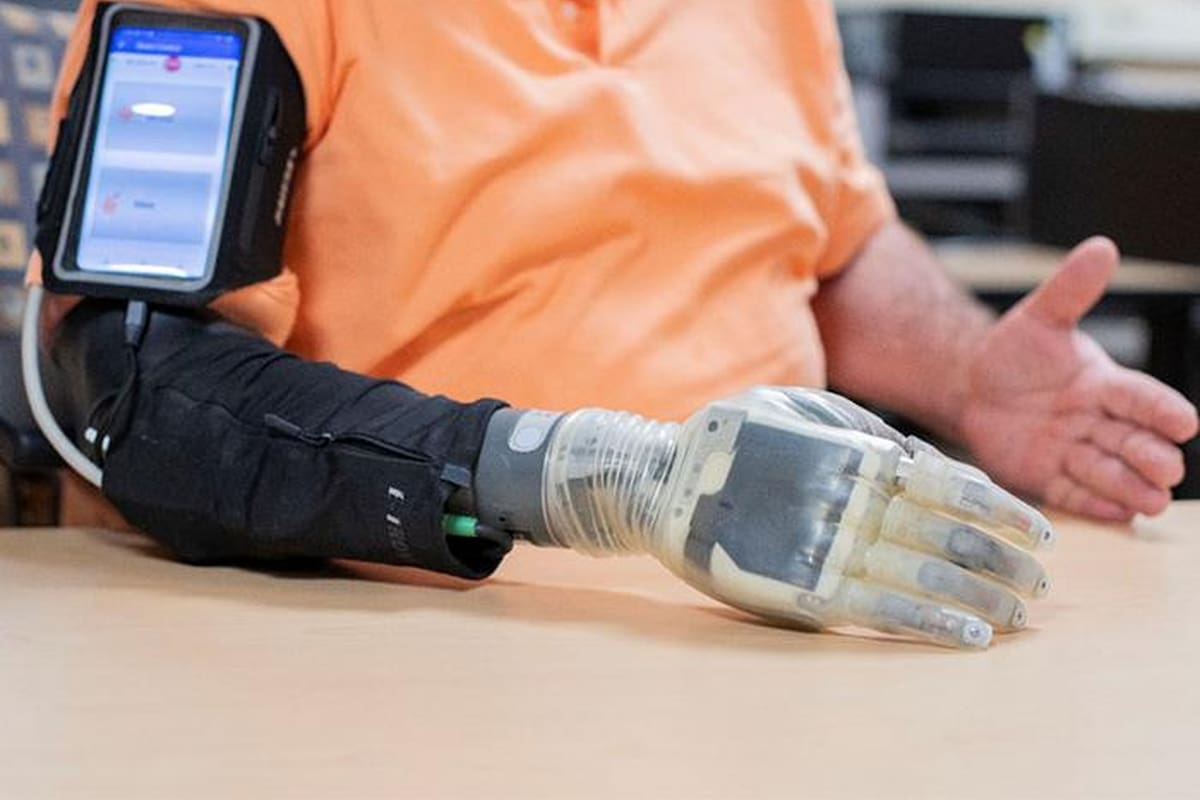 iSens es un sistema que combina una prótesis, un emisor Bluetooth y una serie de electrodos para devolverle el sentido del tacto a una persona que sufrió la amputación de un brazo