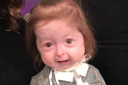 Isla tiene la piel pálida, las vías respiratorias estrechas y una mandíbula pequeña