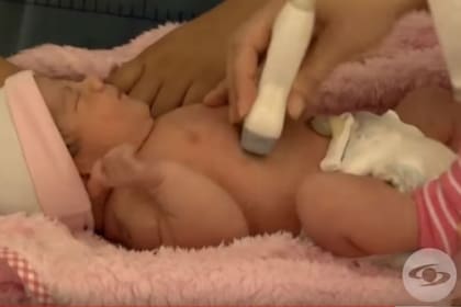 Itzamara debió ser operada recién nacida