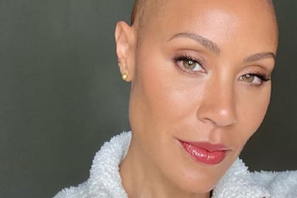 Jada Pinkett Smith compartió una publicación para mostrar los avences de su tratamiento contra la alopecia; en la imagen, el antes