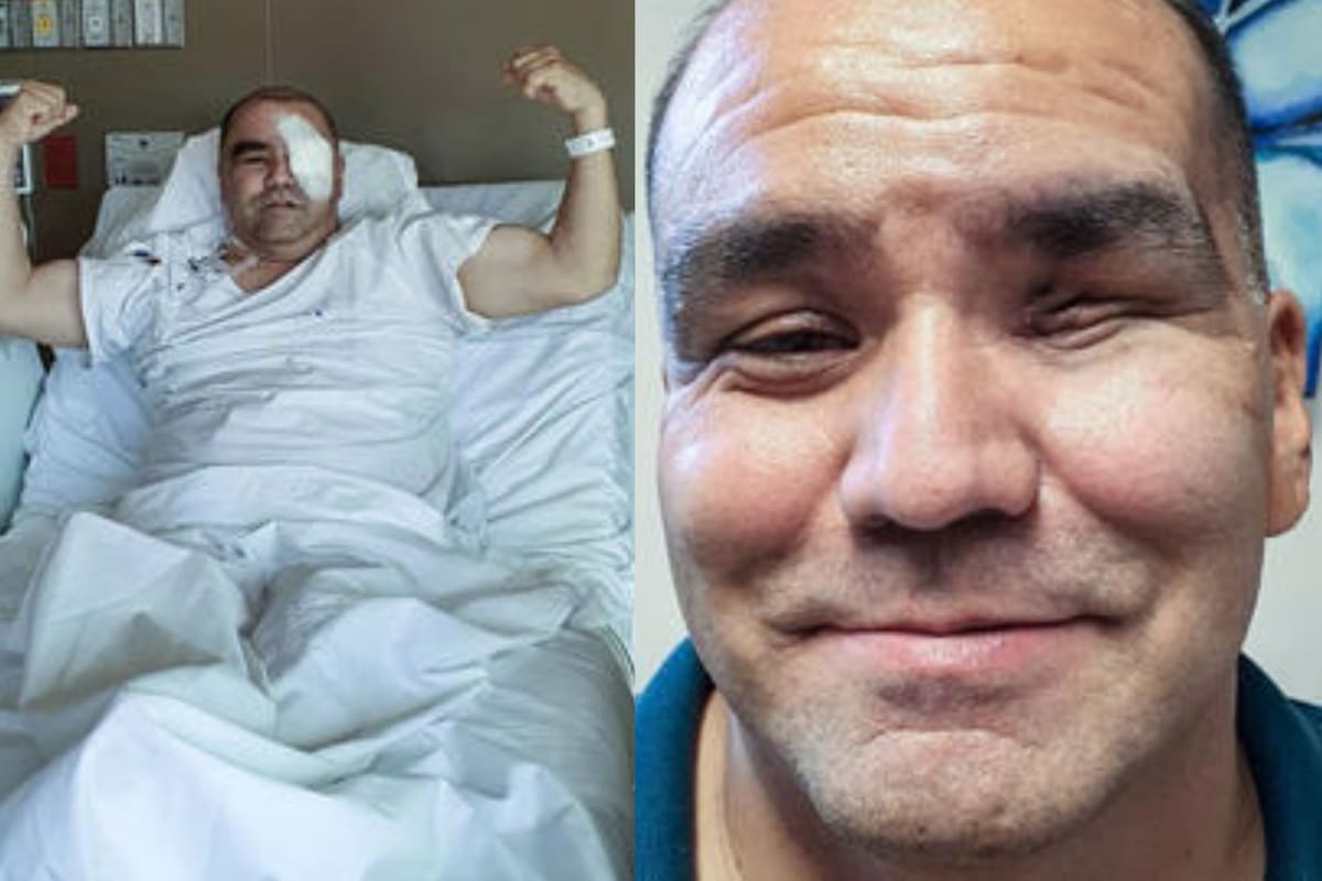 Jaime Díaz de León sobrevivió a la enfermedad del "hongo negro" por la que perdió un ojo y compartió su experiencia