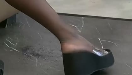 Jenny sufrió una quemadura producto del agua caliente (Foto: Telefe)