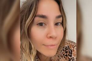 Jimena Barón reveló como "eliminó" arrugas del rostro con un truco casero (Captura video)