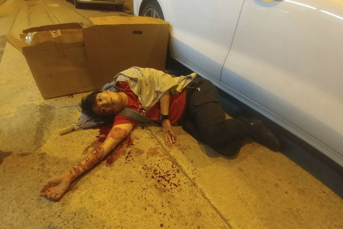 Jimmy Sham, un líder del movimiento prodemócratico de Hong Kong, tras ser agredido