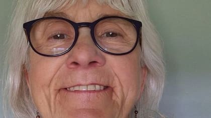 Jo Cameron tiene mutaciones genéticas raras que hacen que casi no sienta dolor o ansiedad