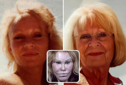 Jocelyn Wildenstein