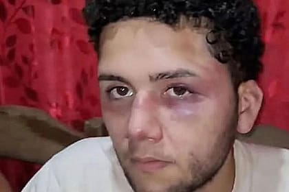 Jonás de Nápoli subió un video en redes sociales mostrando los golpes que presuntamente le dieron el jefe y sus hijos