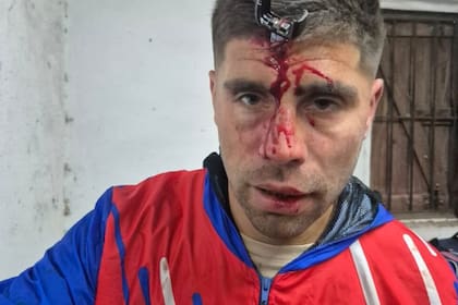 Jonathan Smith, el exjugador de General Lamadrid, luego de recibir la agresión