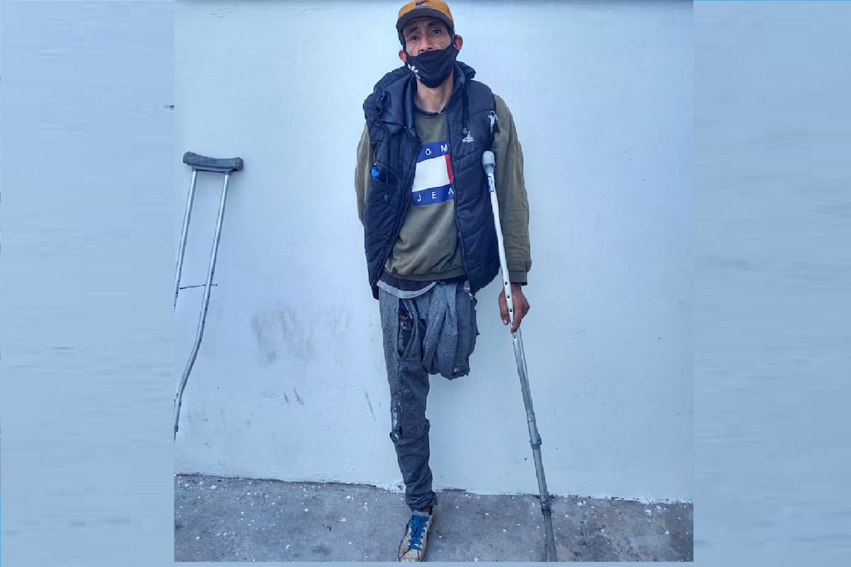 Juan Carlos Gauna, un ladrón reincidente al que el hecho de haber perdido una pierna en un enfrentamiento con la policía no le resulta un obstáculo en su carrera criminal