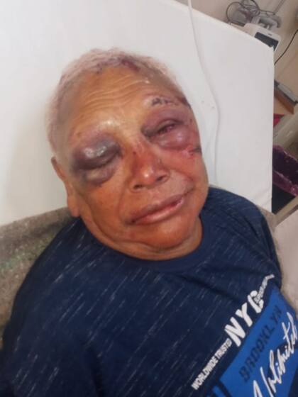 Jubilado desfigurado por ladrones en La Plata
