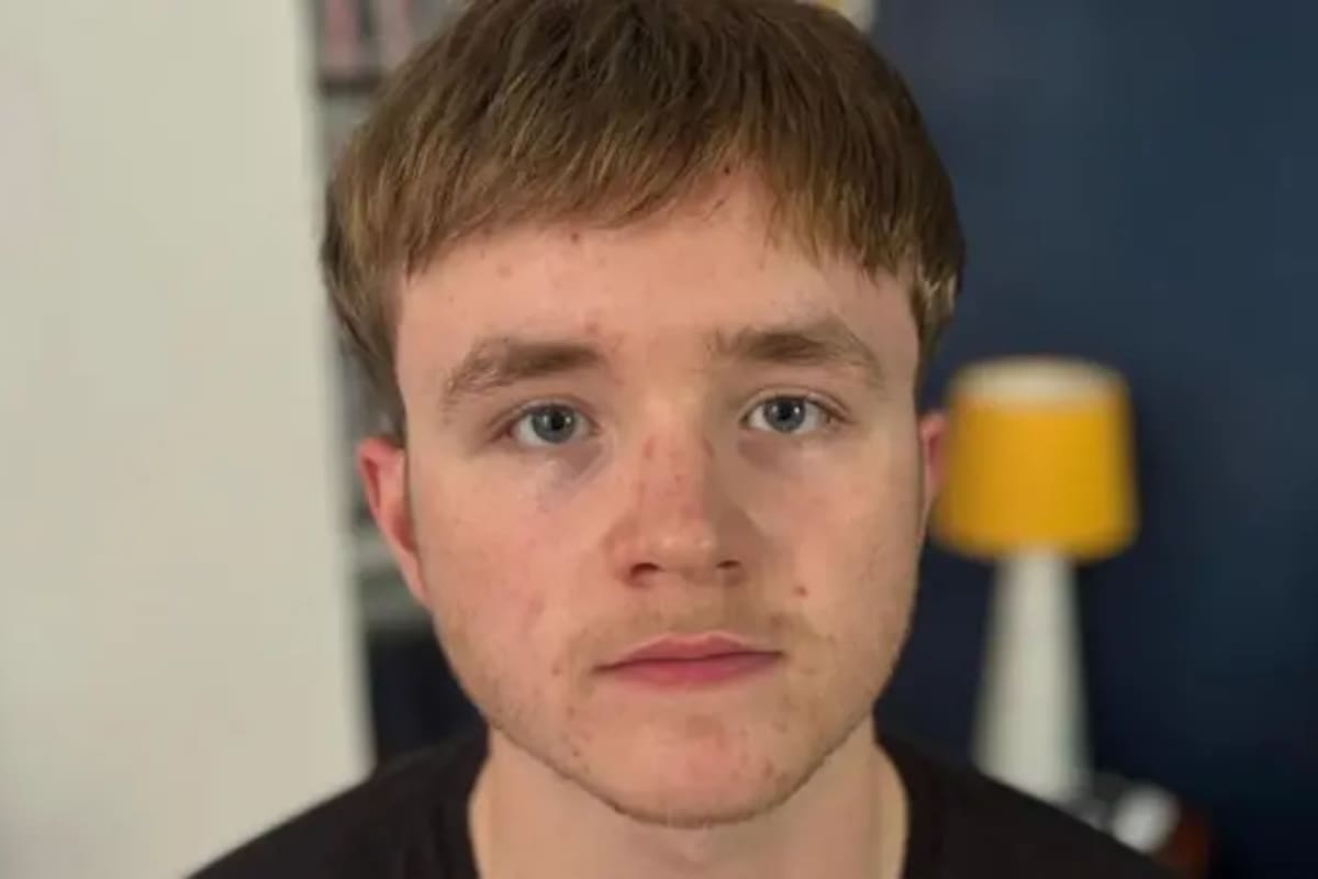 Judah Cousin, quien usa una pieza de cabello semipermanente, comenzó a perder su cabello a los 16 años y dice que el proceso fue "agotador"