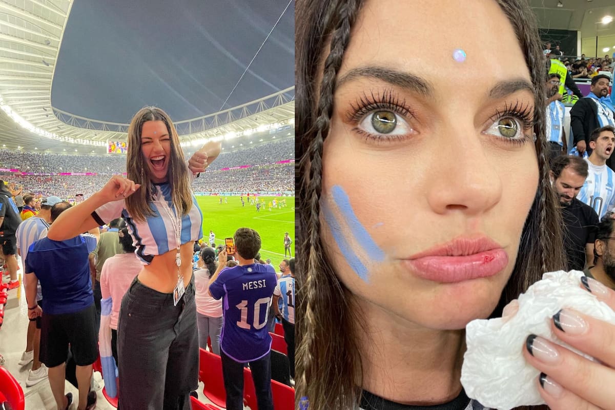 Jujuy Jiménez recibió un golpe tras el segundo gol y le sangró el labio.