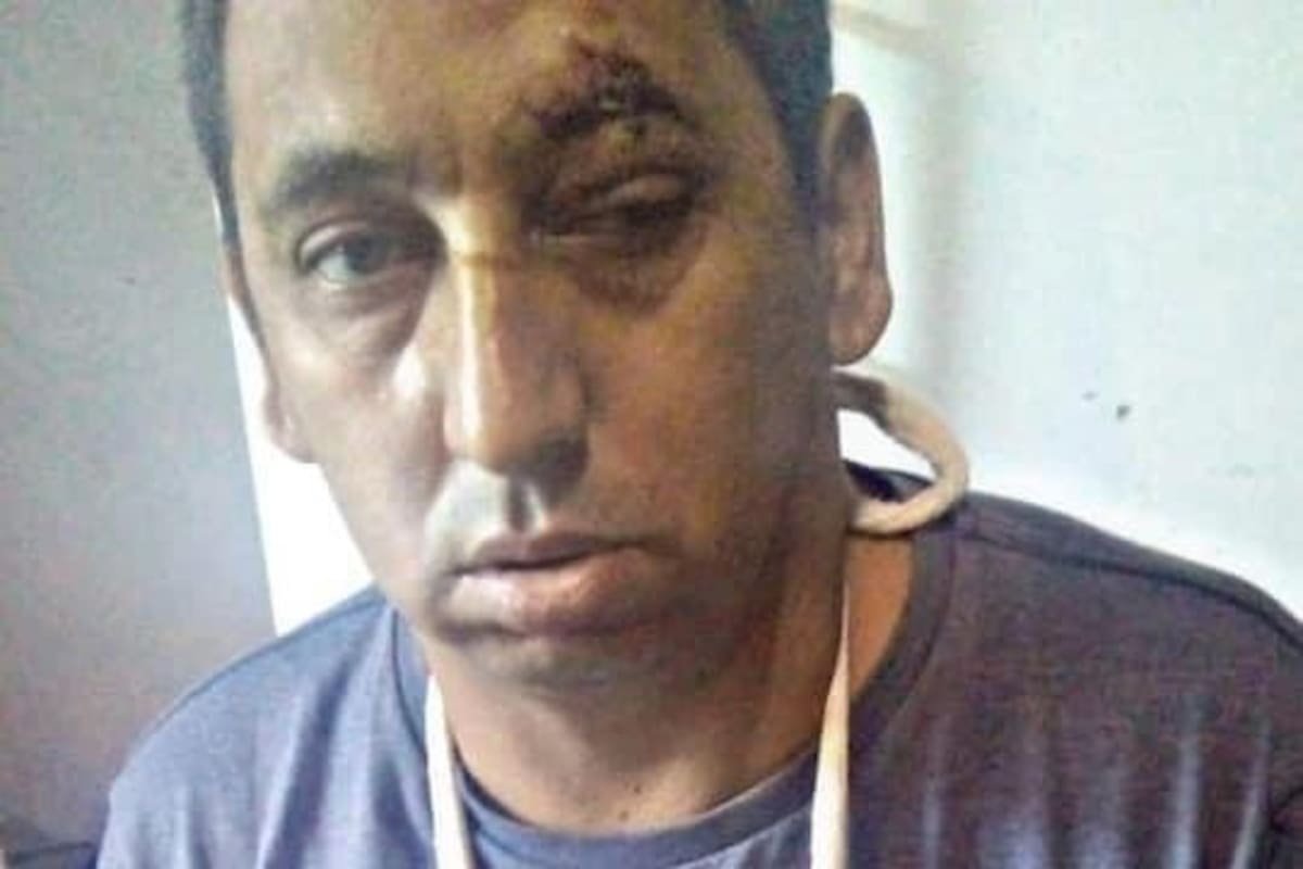 Julio Bulacio, militante del Movimiento Evita agredido en Lanús