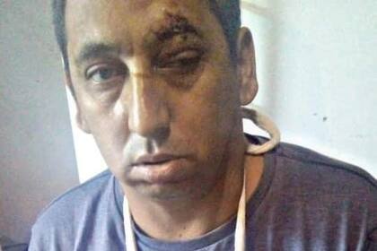 Julio Bulacio, militante del Movimiento Evita agredido en Lanús