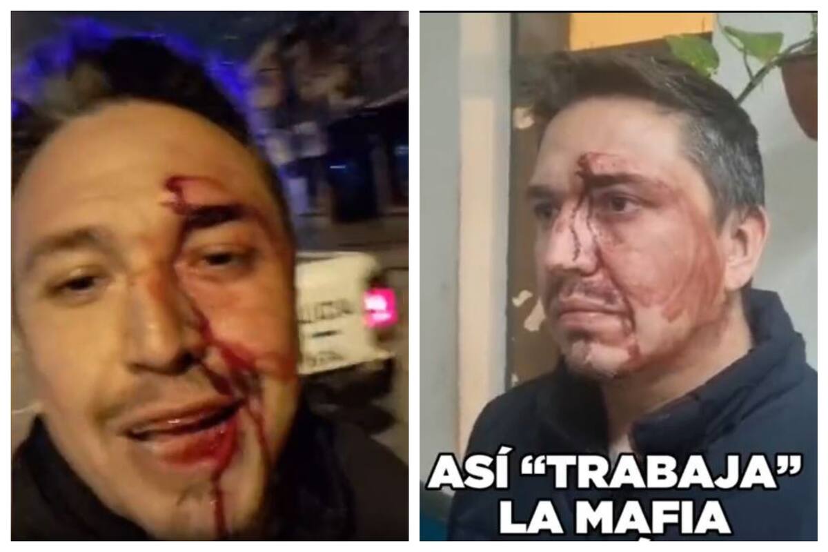 Juntos por el Cambio denunció que agredieron a un concejal en Merlo.