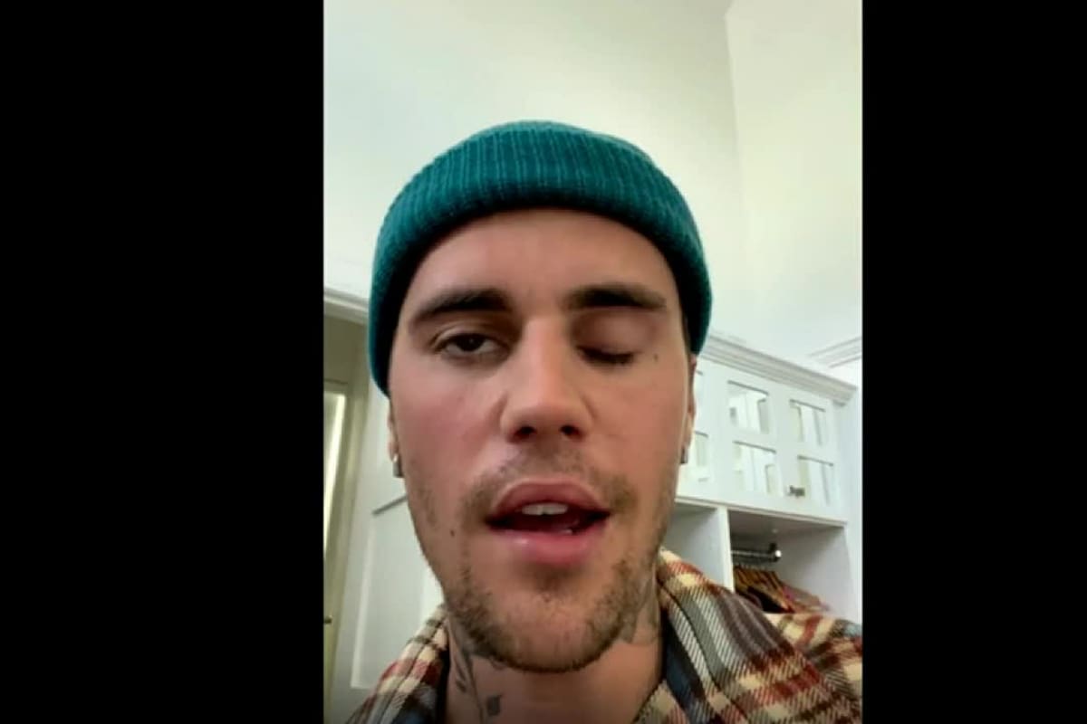 Justin Bieber está con media cara paralizada