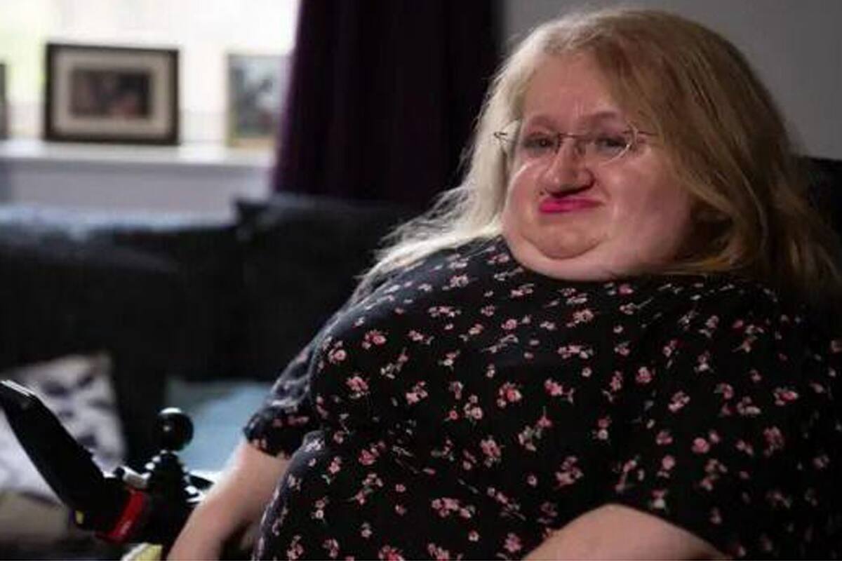 Kat Watkins; Discapacidad; Fracturas; BBC; BBC Mundo