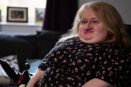 Kat Watkins; Discapacidad; Fracturas; BBC; BBC Mundo