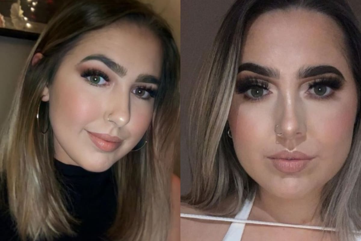 Katie Harpur se debilitó tanto que no podía caminar y fue hospitalizada (Foto: Instagram @katieharpur)