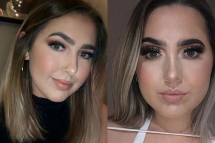 Katie Harpur se debilitó tanto que no podía caminar y fue hospitalizada (Foto: Instagram @katieharpur)