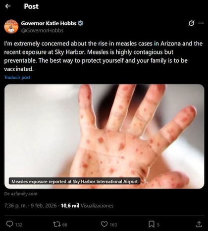 Katie Hobbs alerta a la población por la propagación del virus del sarampión