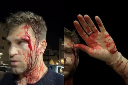 Keegan Allen, actor de Pretty Little Liars, fue abordado por dos delincuentas a la salida de un supermercado de West Hollyood; le robaron el reloj y lo golpearon (Foto: Instagram @keeoone)