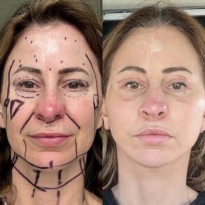 Kelly Beasley, de 50 años, vendió su casa y usó el dinero para pagar una cirugía plástica
