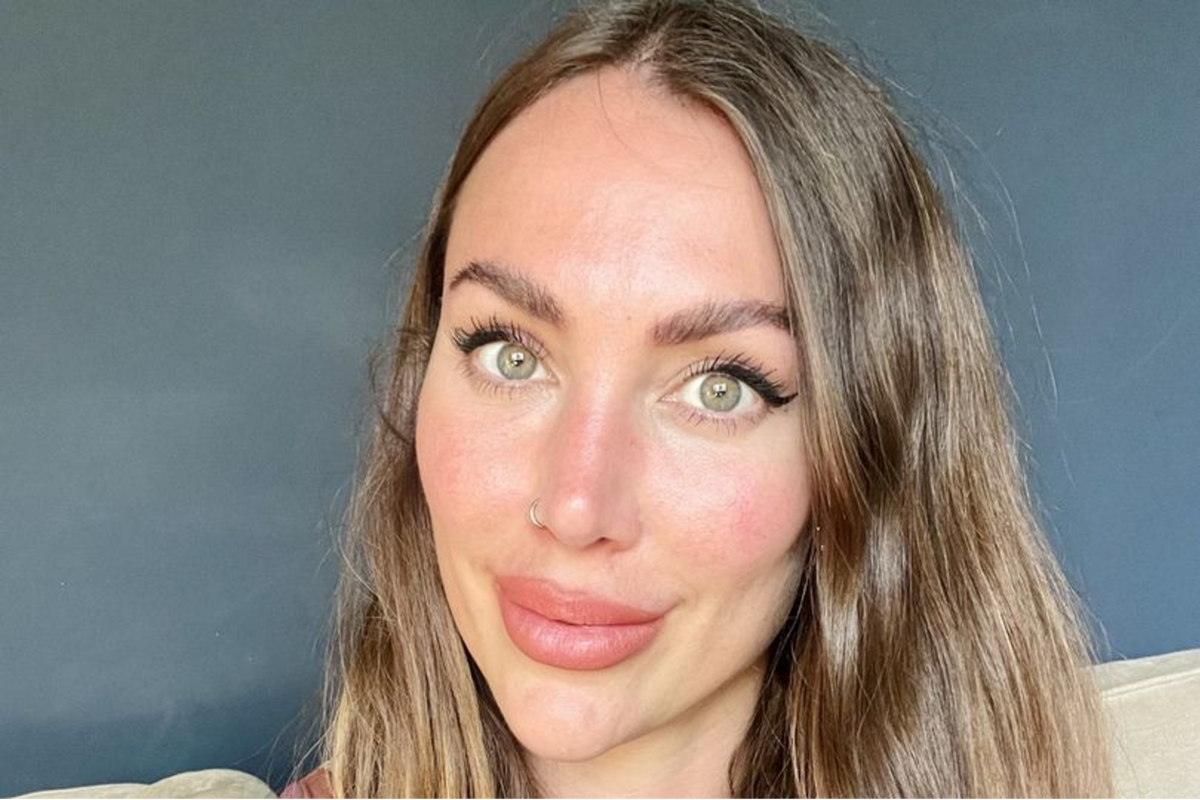 Kim Booker cayó en depresión al sufrir las consecuencias de los procedimientos estéticos a los que se sometió