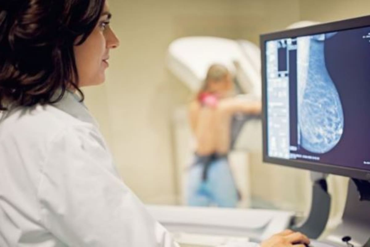 King estableció la naturaleza hereditaria del cáncer de mama e identificó mutaciones en el gen BRCA1 como un defecto molecular crítico, explica Elmore. Imagen: Getty