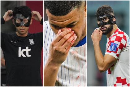 Kylian Mbappé, con fractura de nariz, intentará seguir jugando en la Euro 2024, pero deberá utilizar una máscara, como en su momento lo hicieron Son Heung-min y Josko Gvardiol, entre otros