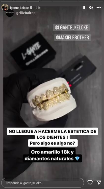 L-Gante enseñó su nueva dentadura