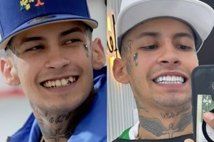 L-Gante se cambió radicalmente la sonrisa y sorprendió: su antes y después. Foto/Instagram: @lgante_keloke