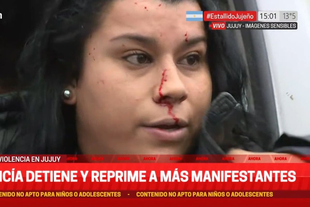 La activista que se golpeó adrede con la ventanilla de un patrullero y C5N muestra como víctima de la represión