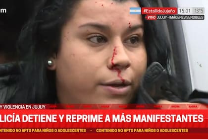 La activista que se golpeó adrede con la ventanilla de un patrullero y C5N muestra como víctima de la represión