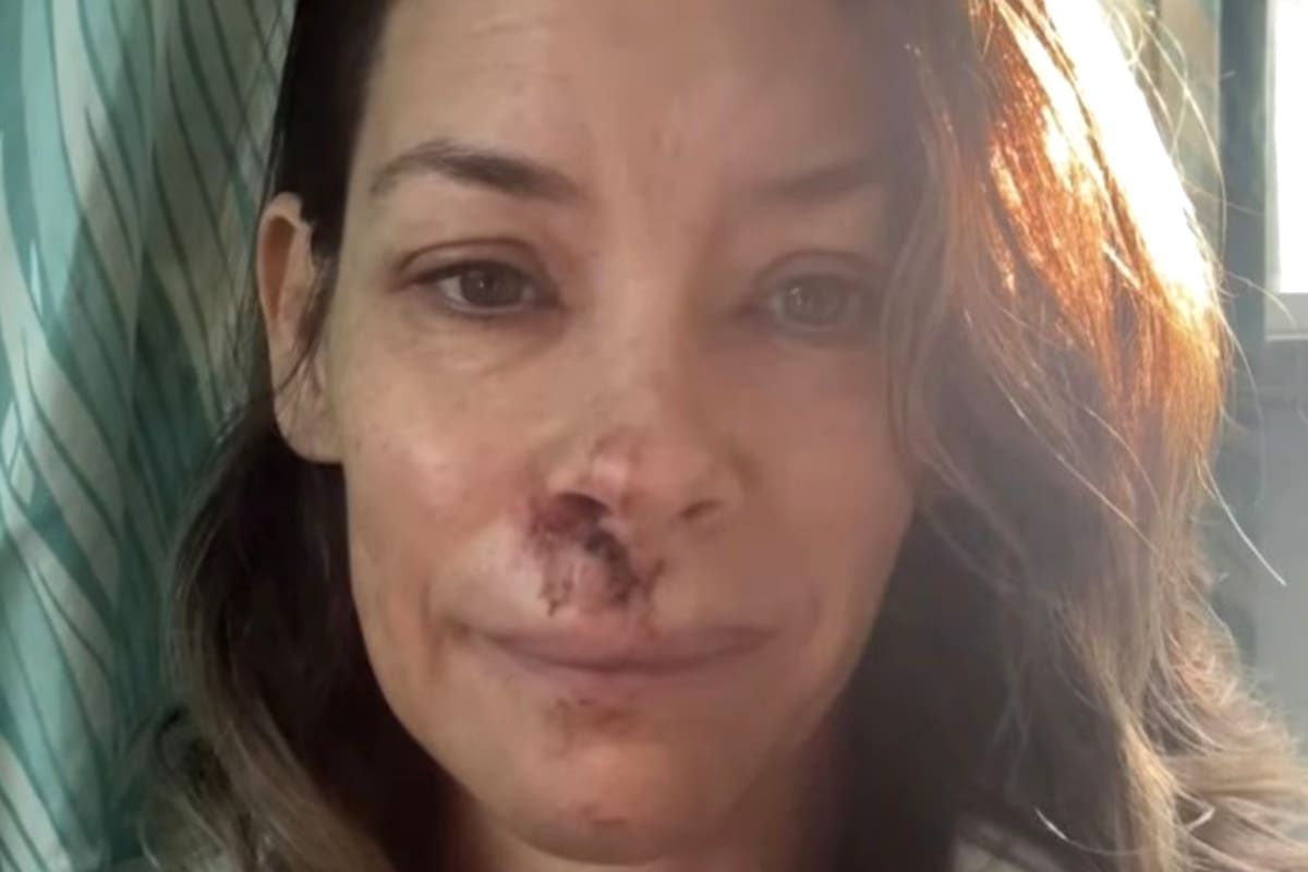 La actriz Evangeline Lily reveló en un video que posteó en Instagram que tiene daño cerebral como consecuencia de un accidente que sufrió el pasado mayo en Hawái