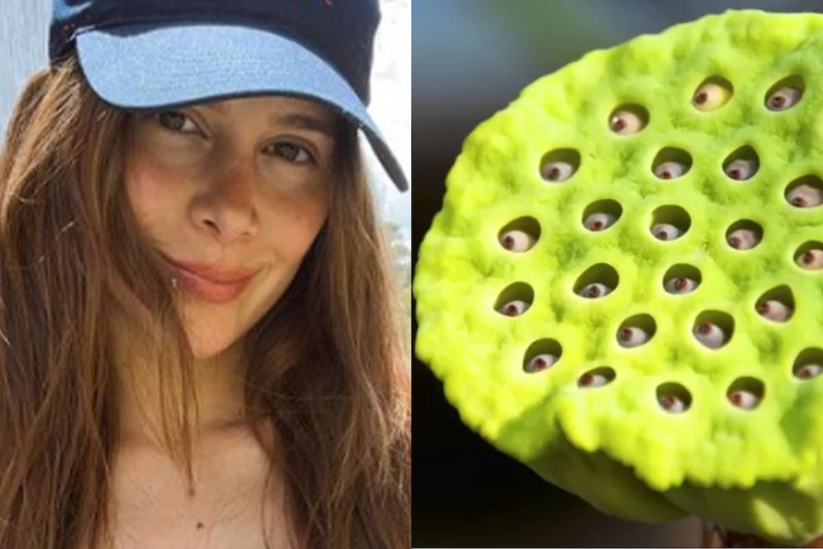 La actriz le contó a sus seguidores en Instagram que padece tripofobia