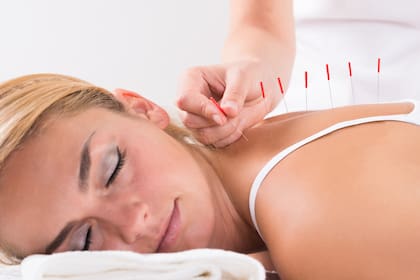 La acupuntura es un tratamiento que consiste en activar lugares específicos del cuerpo, por lo general a través de agujas muy delgadas