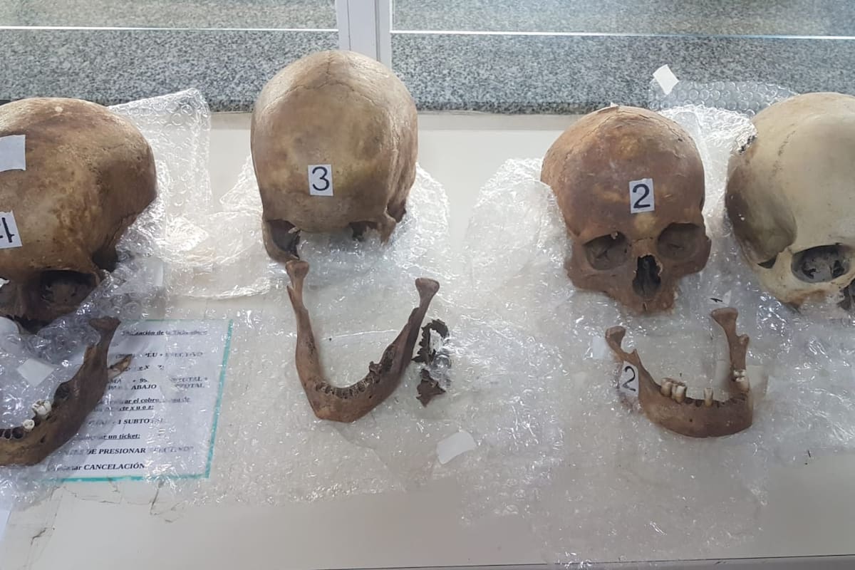 La Aduana halló cuatro cráneos en una valija de una pasajera que ingresaba al país desde Paraguay