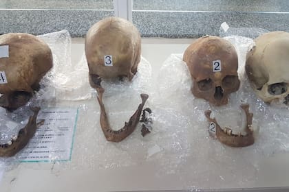 La Aduana halló cuatro cráneos en una valija de una pasajera que ingresaba al país desde Paraguay