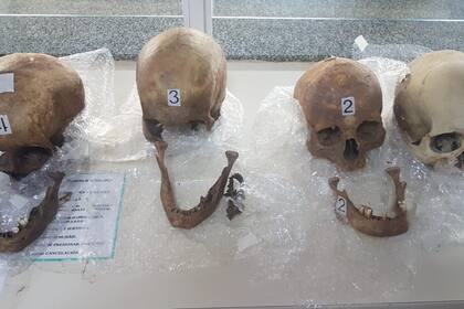 La Aduana halló cuatro cráneos en una valija de una pasajera que ingresaba al país desde Paraguay