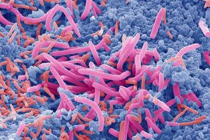 La alteración de la microbiota intestinal tiene un efecto proinflamatorio