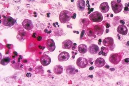 La ameba entra al organismo por la nariz y de allí migra hacia el cerebro