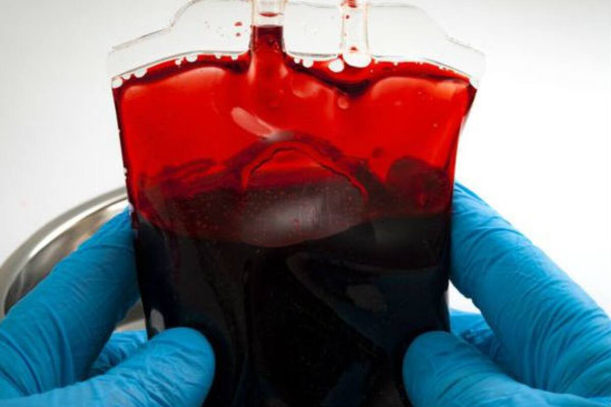 La "sangre dorada" es uno de los tipos de sangre más extraños que existen