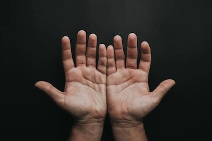 La aparición de manchas en las manos es frecuente; ¿cuál es la razón? (Foto Pexels)