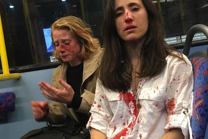 La azafata y su pareja, tras el ataque en un colectivo en Londres