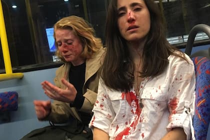 La azafata y su pareja, tras el ataque en un colectivo en Londres