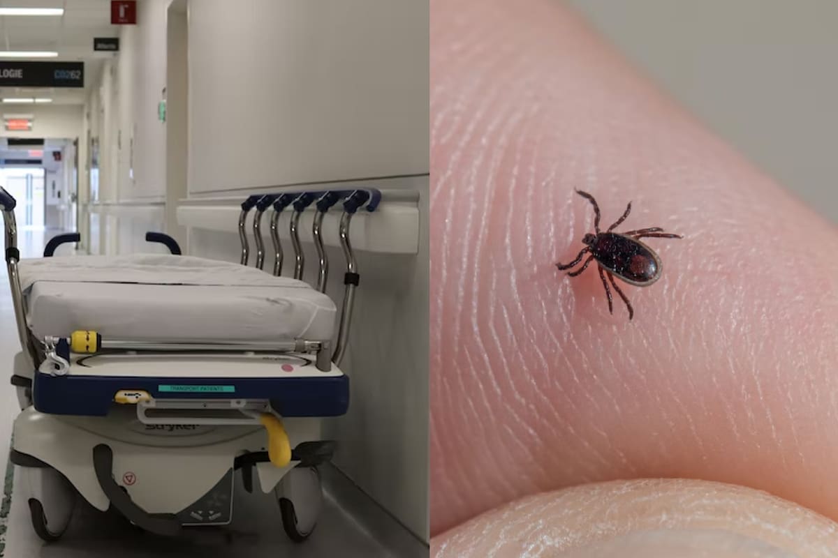 La babesiosis se transmite comúnmente a través de las garrapatas, sin embargo, existen otras formas de contagio, como las transfusiones sanguíneas