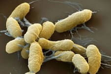 “Yersinia pestis integra la categoría A de agentes de bioterrorismo”, afirma un infectólogo